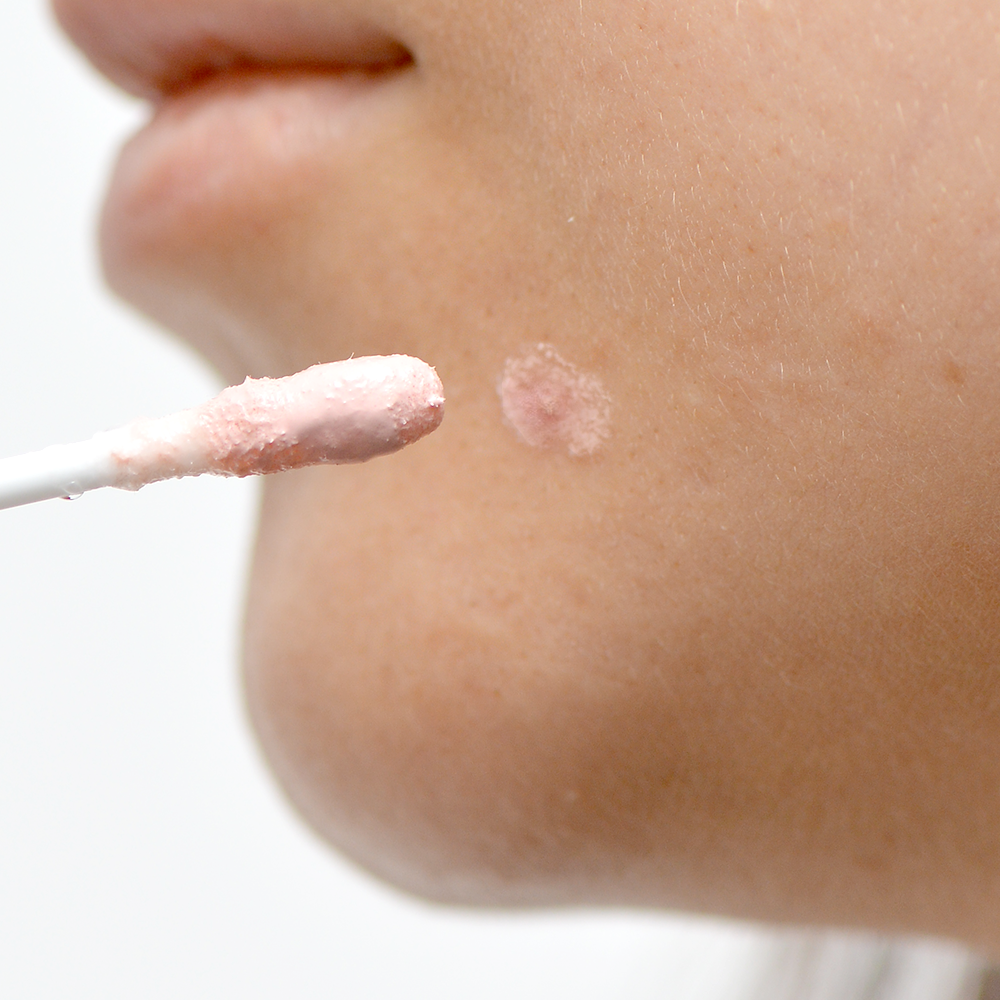 Лосьон подсушивающий с 10% серой M.A.D Acne Drying Lotion w Sulfur 10% 30 мл