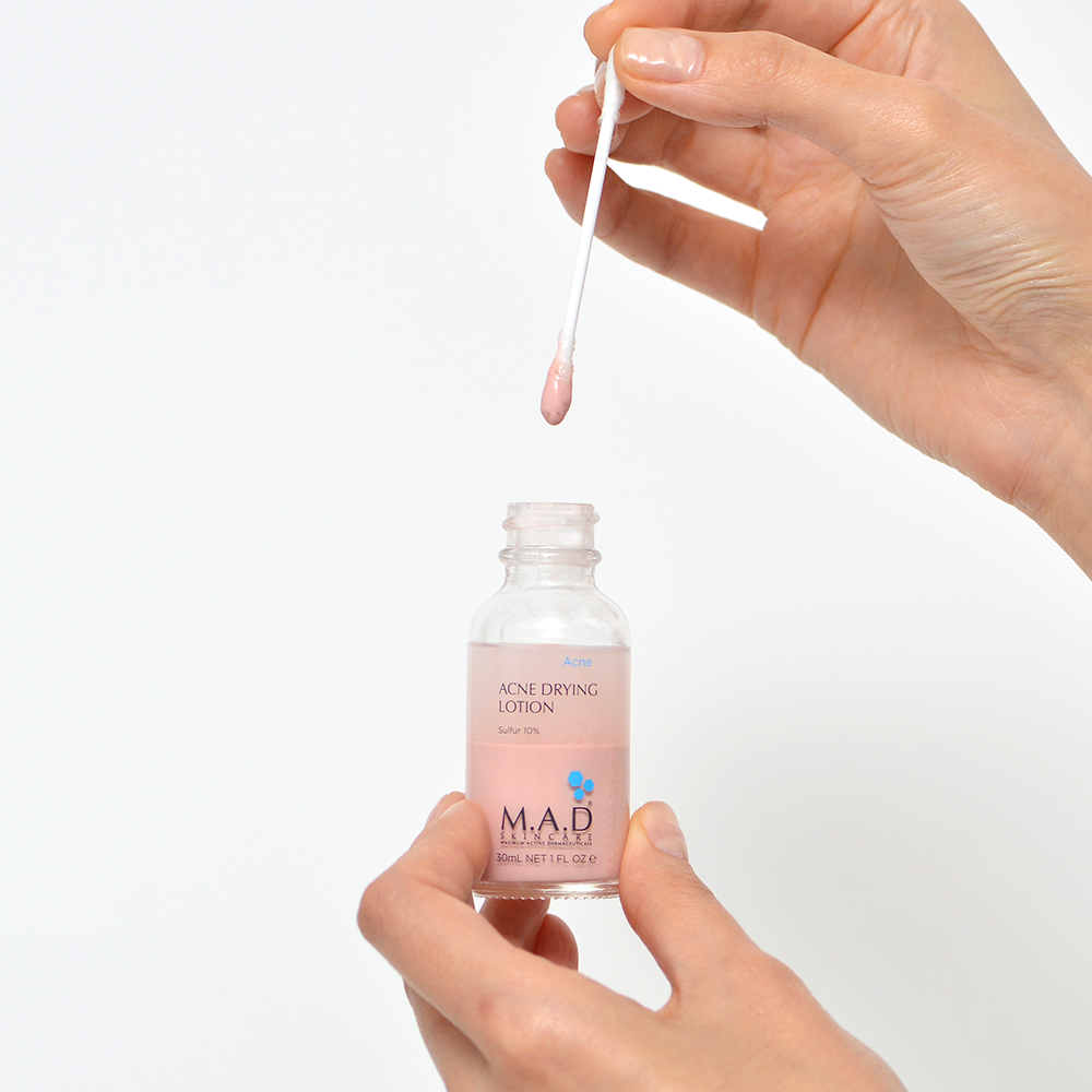 Лосьон подсушивающий с 10% серой M.A.D Acne Drying Lotion w Sulfur 10% 30 мл